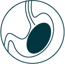cum-este-plasat-balonul-gastric